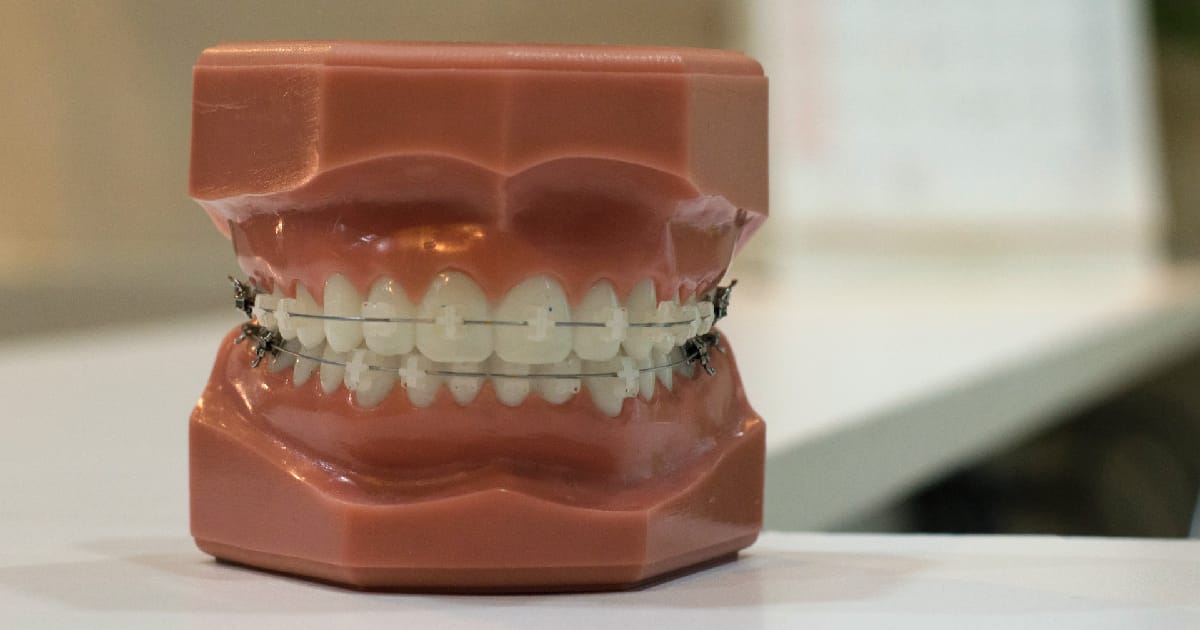 Зубні пасти: на які інгредієнти слід звернути увагу у складі. - Safety Makeup на we.ua