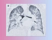 Картинка з посилання