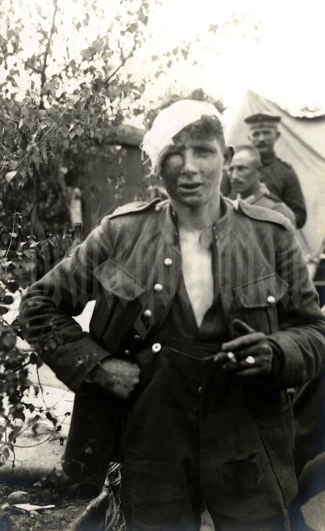 Поранений британський полонений