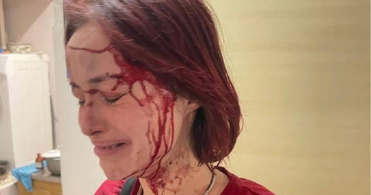 People fear persecution from the authorities and cannot speak the truth even on social networks - qxxx на we.ua