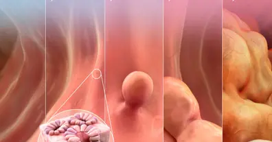 Картинка довгочиту