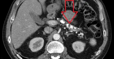 Картинка довгочиту