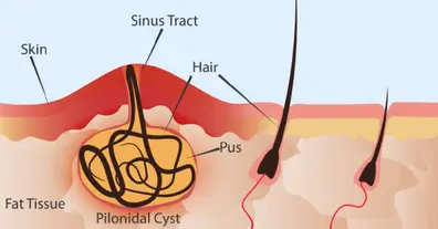 Картинка довгочиту