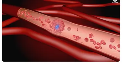 Картинка довгочиту