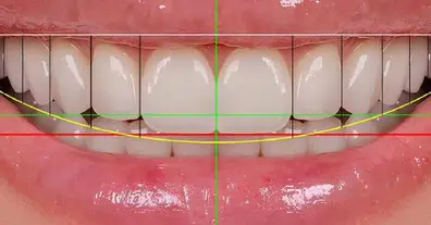 Longread image