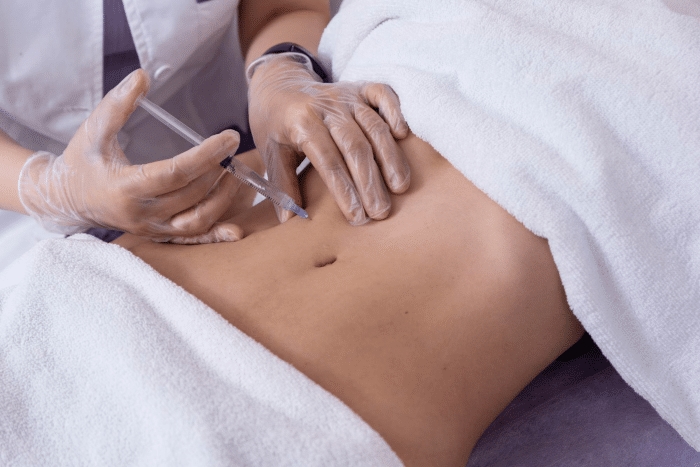 Hyacorp Filler: Treatment Areas & Results