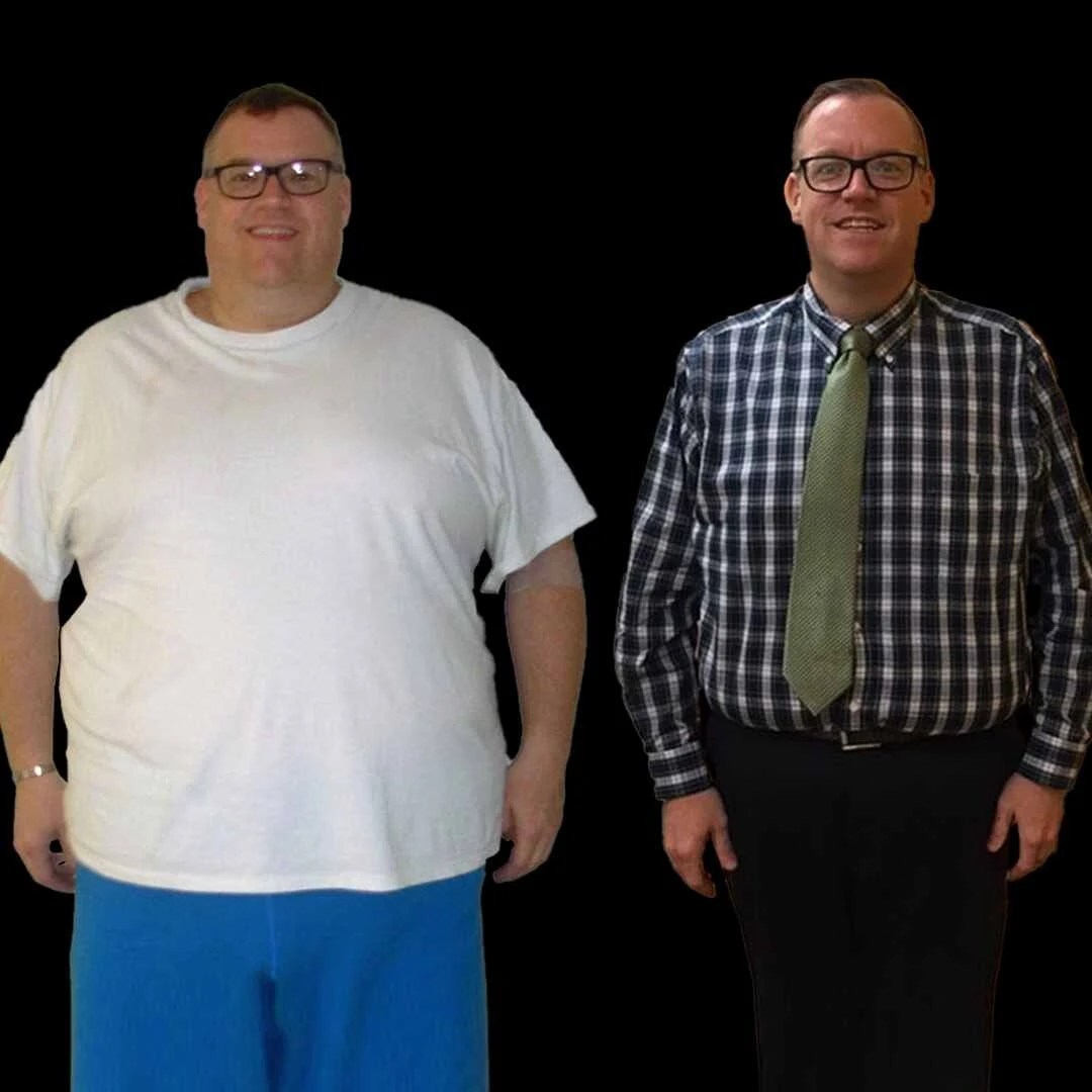Mini Gastric Bypass In Dubai Abu Dhabi - Best Mini Gastric Bypass Surgeon Dubai Abu Dhabi