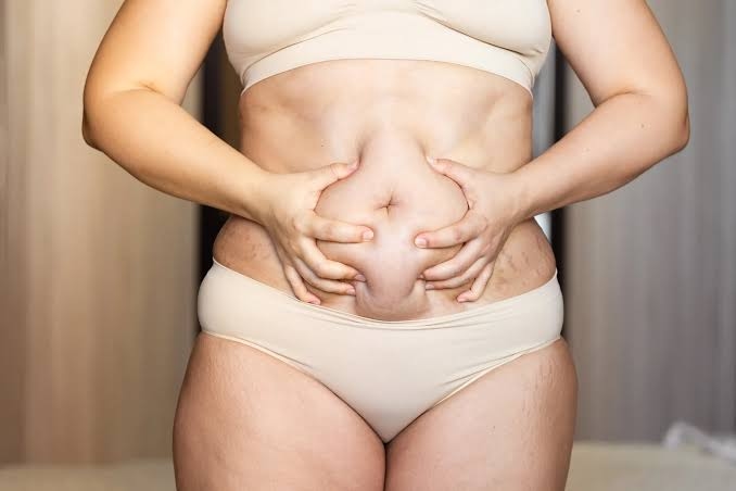 How much does gastric sleeve surgery cost? - Alabama Bariatrics