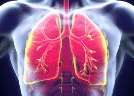 Lung Transplantation in Rheumatic Lung Disease: The Importance of a  Multidisciplinary Approach